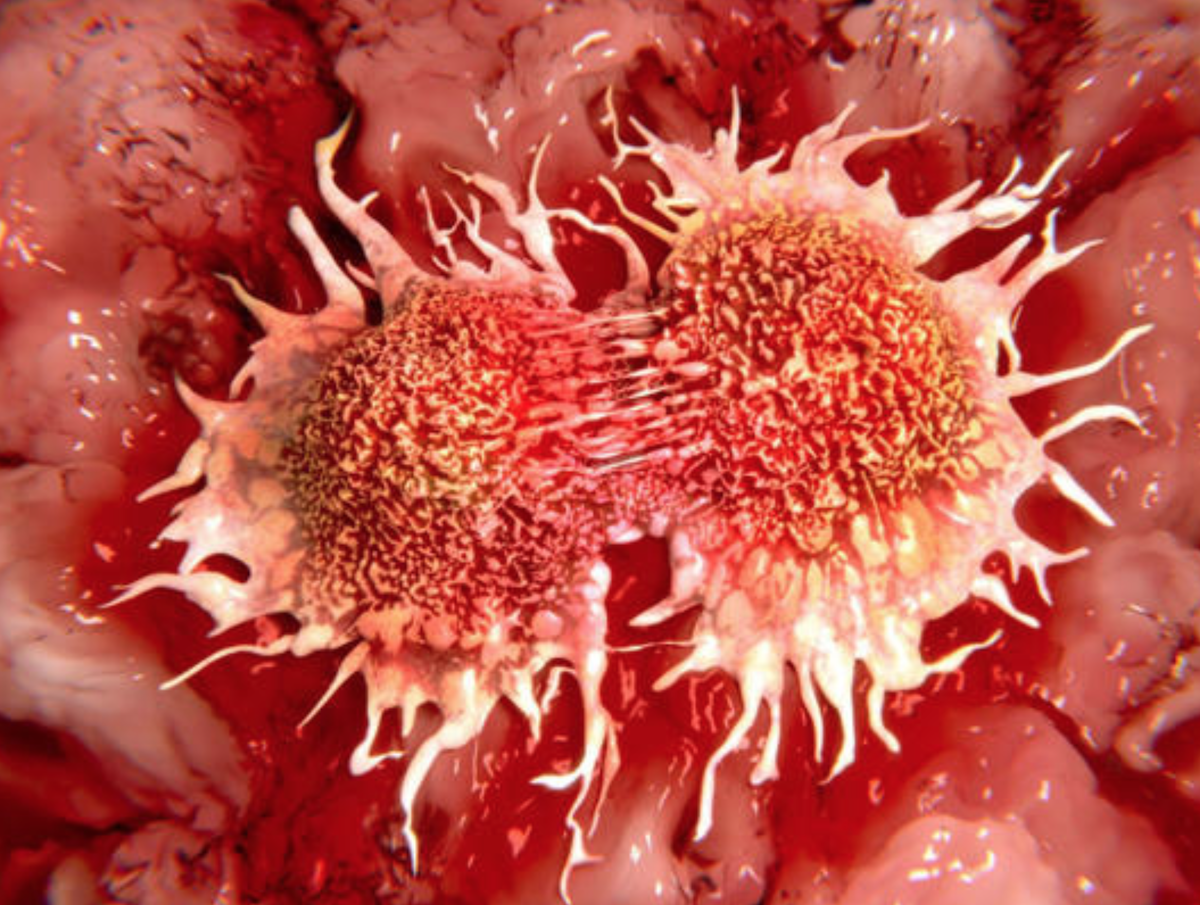 Estudio revela origen del cáncer y la posible evolución de cada tumor